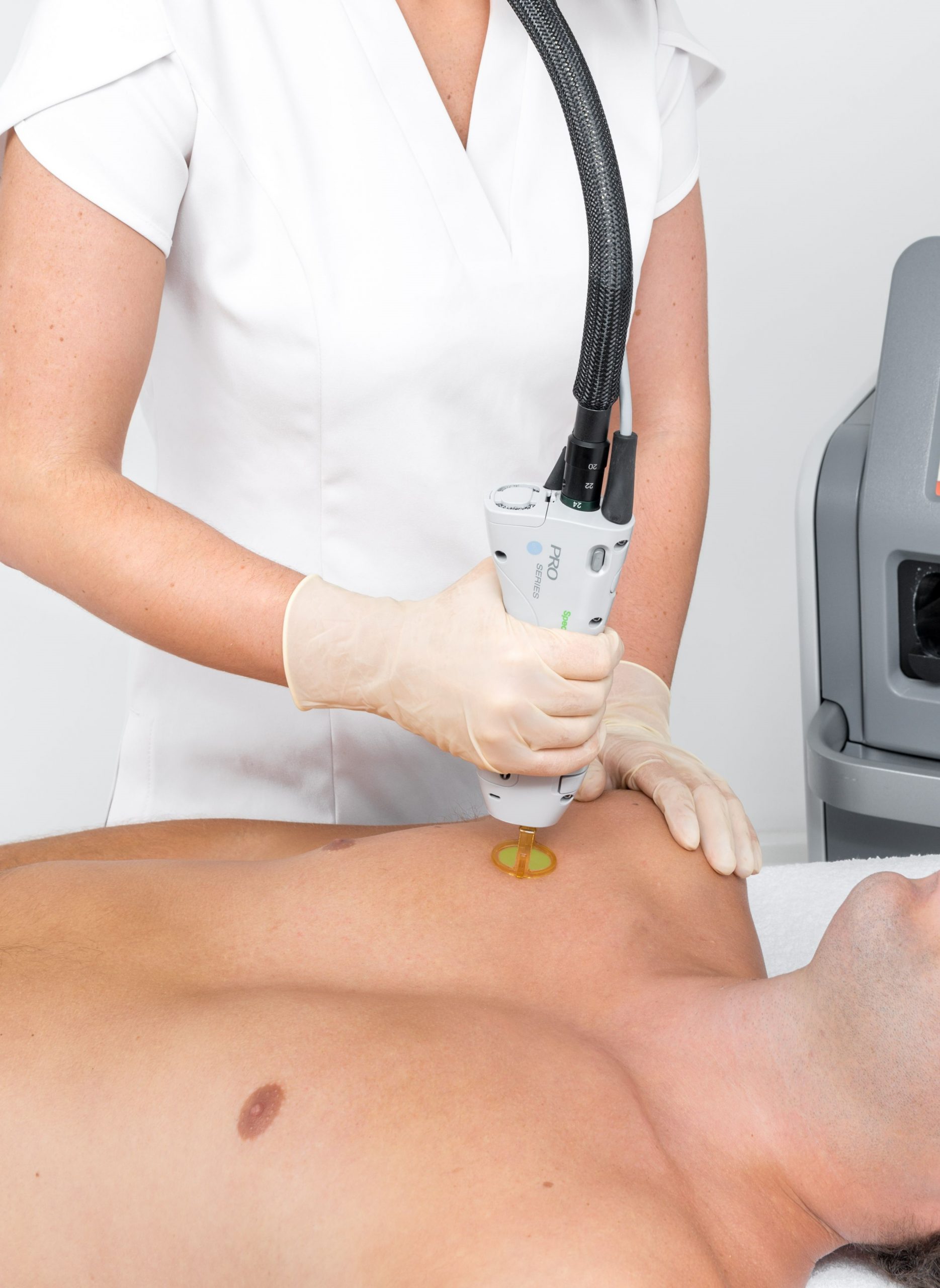 Laser Hair Removal Newcastle