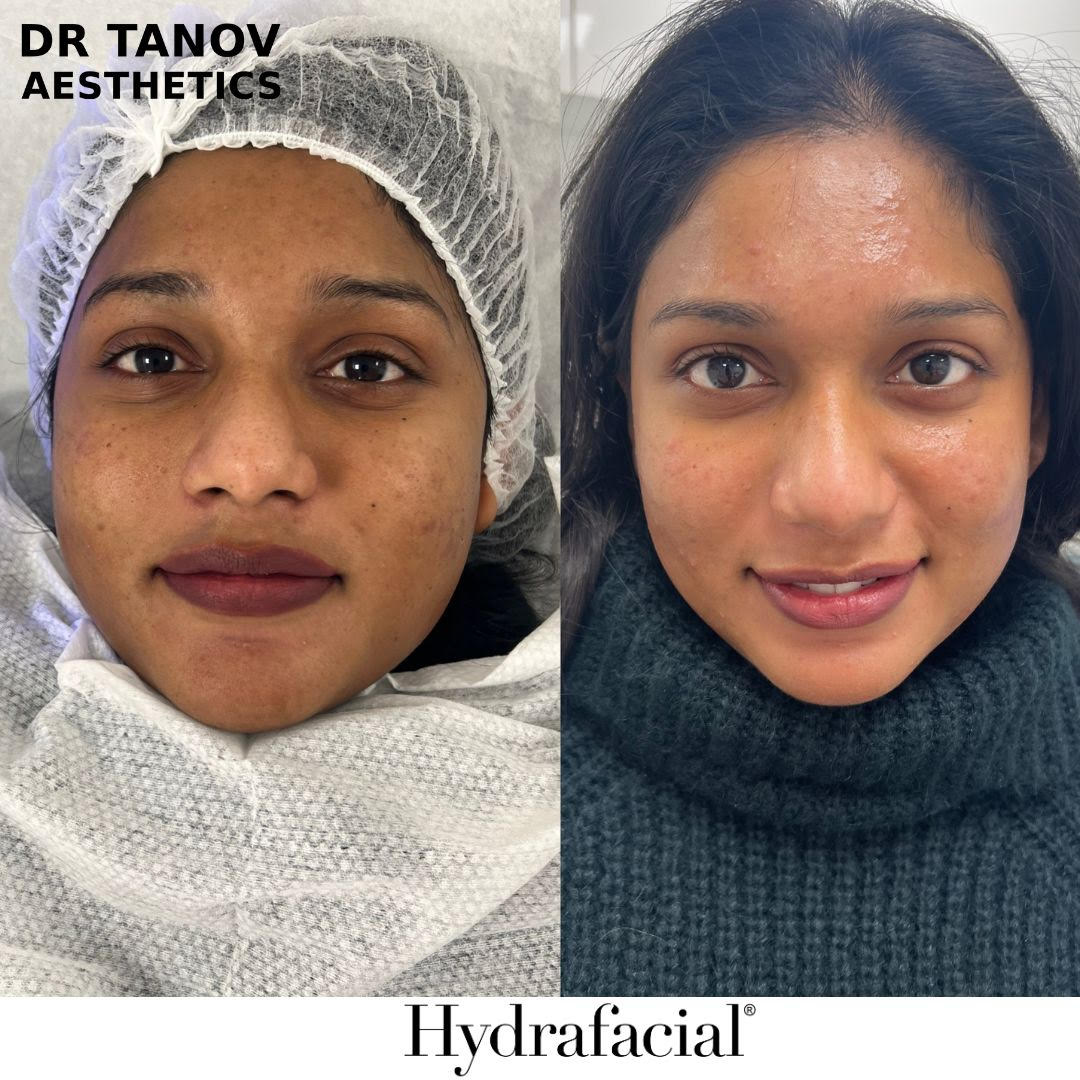 xr:d:DAF8Uq5a8oo:6,j:7710580730394581927,t:24020918