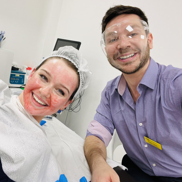 Skinpen Treatment
