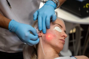 How Much Does Endolift Cost