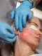 How Much Does Endolift Cost