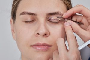 Blepharoplasty A Complete Guide To Eyelid Surgery