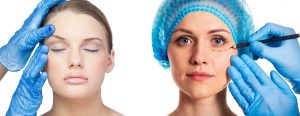 Blepharoplasty VS Brow Lift: Key Differences & Decision Guide