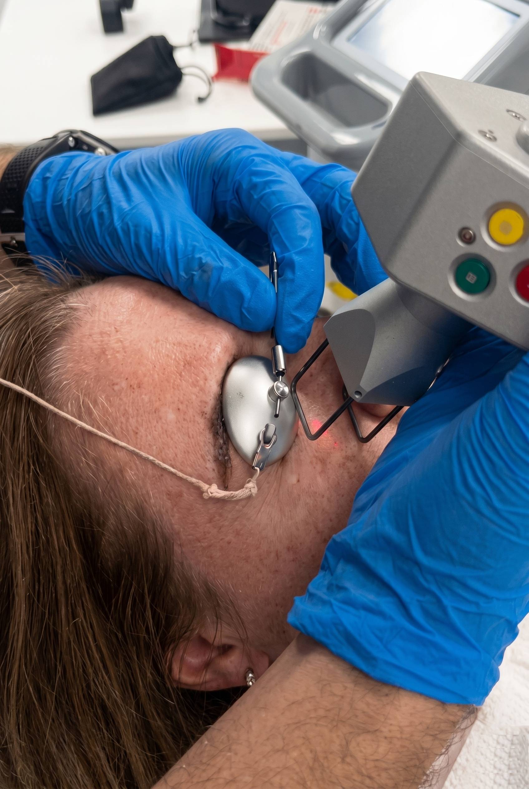 Non-Surgical Blepharoplasty