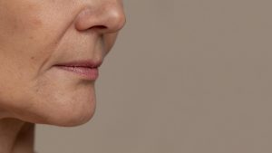 Everything You Need to Know About Sagging Jowls