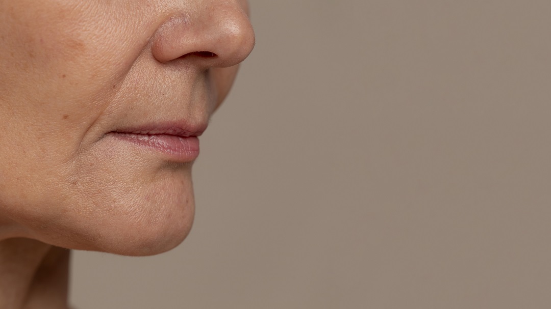 Everything You Need to Know About Sagging Jowls