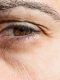 How to Get Rid of Under Eye Wrinkles