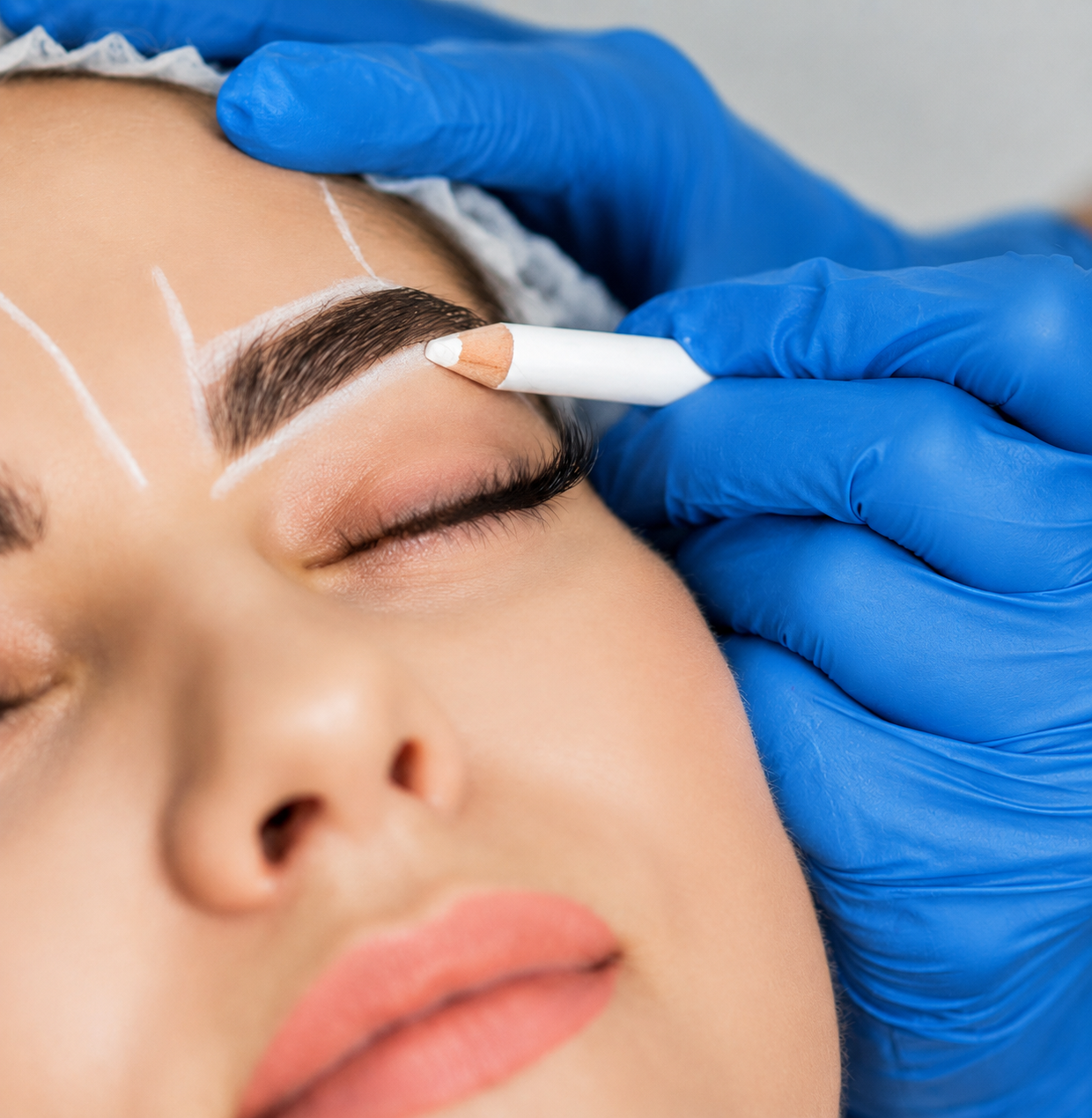 Brow Lift Surgery by Dr Kalin Tanov