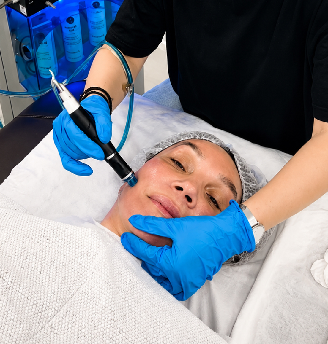 HydraFacial in Newcastle — Dr Tanov