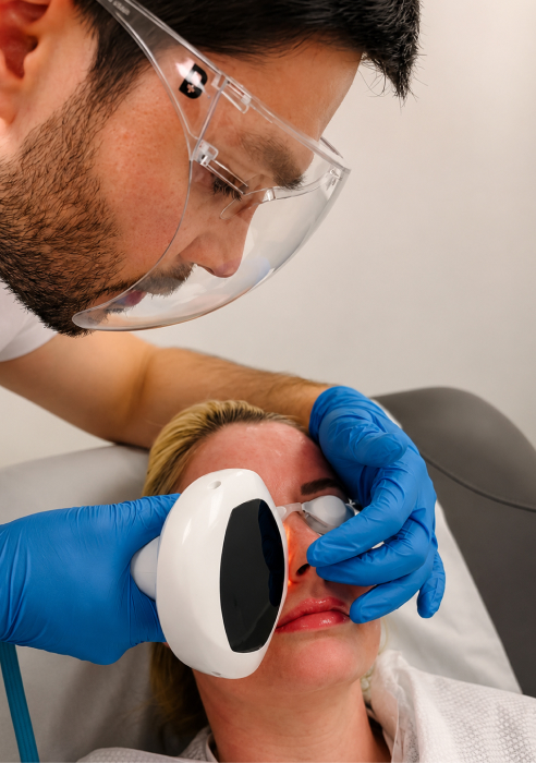 What are thread veins and facial redness