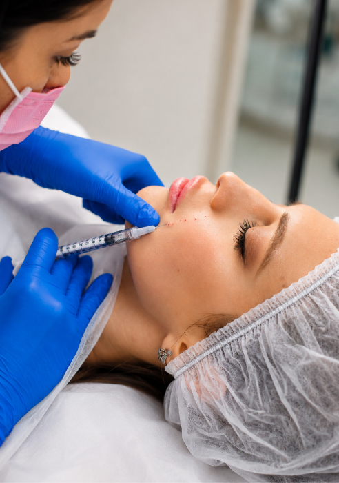 Bio-Filler and PRF treatment in Newcastle