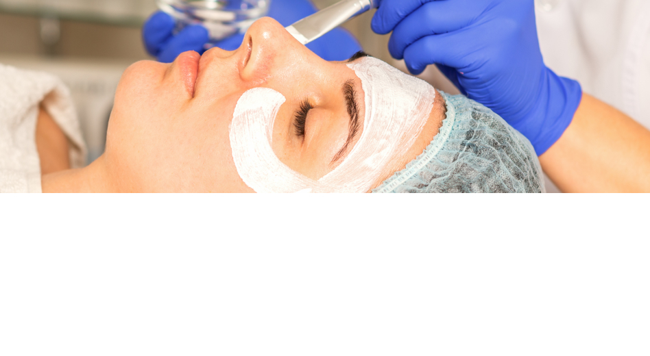 Chemical Peel