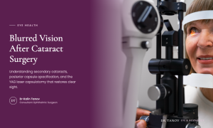 Blurred Vision After Cataract Surgery