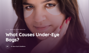What Causes Eye Bags