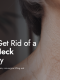 How to Get Rid of Saggy Neck