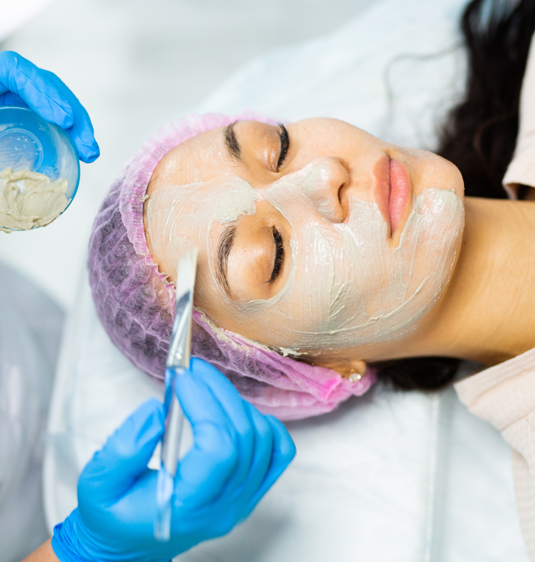 Facial Peel Treatments Newcastle — Dr Tanov