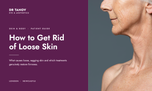 Loose Skin