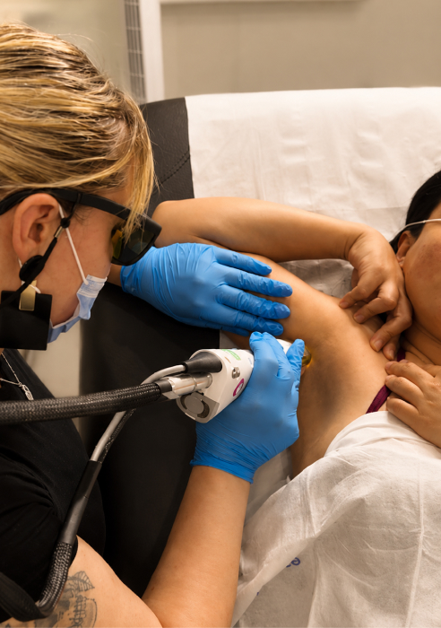 What is laser hair removal
