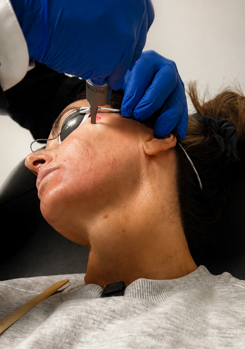 What is picosure pigmentation treatment