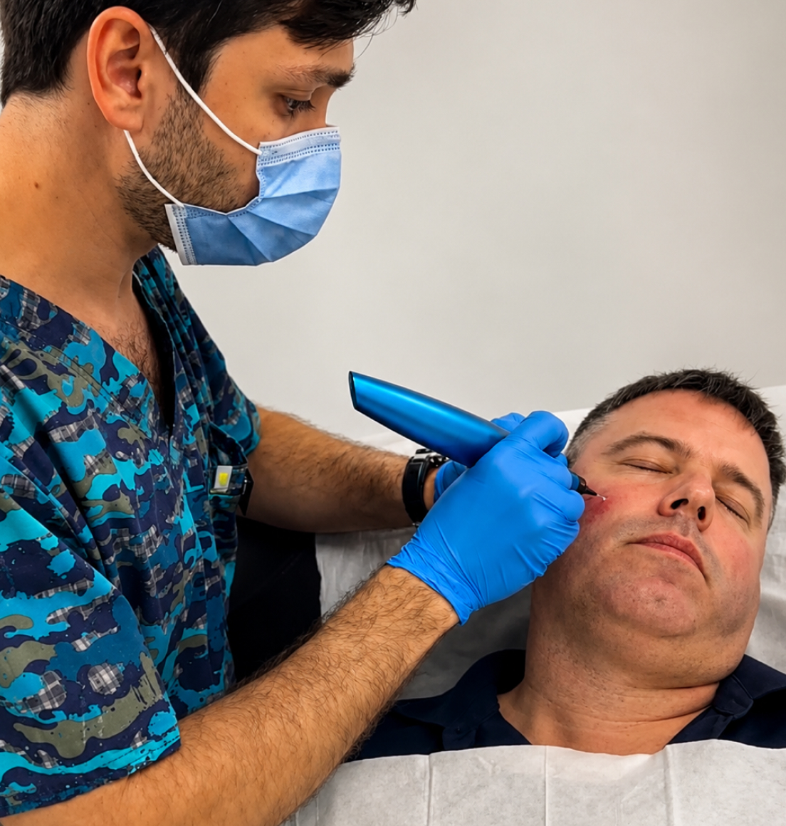 Skin Tag Removal in Newcastle — Dr Tanov