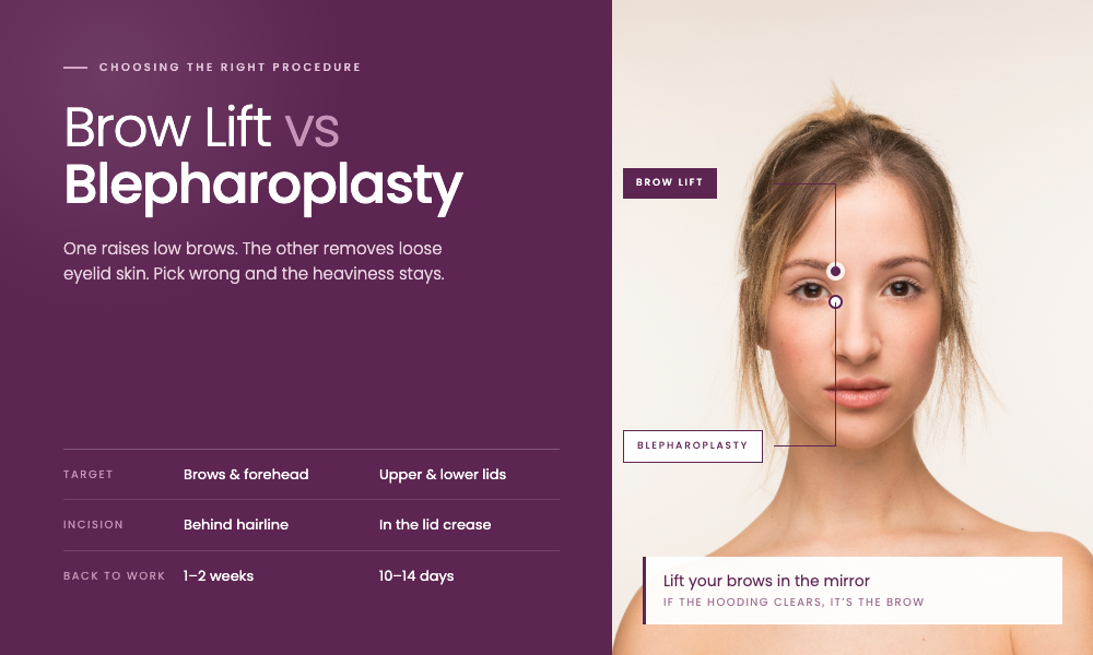Brow Lift vs Blepharoplasty