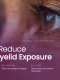 How to Reduce Upper Eyelid Exposure