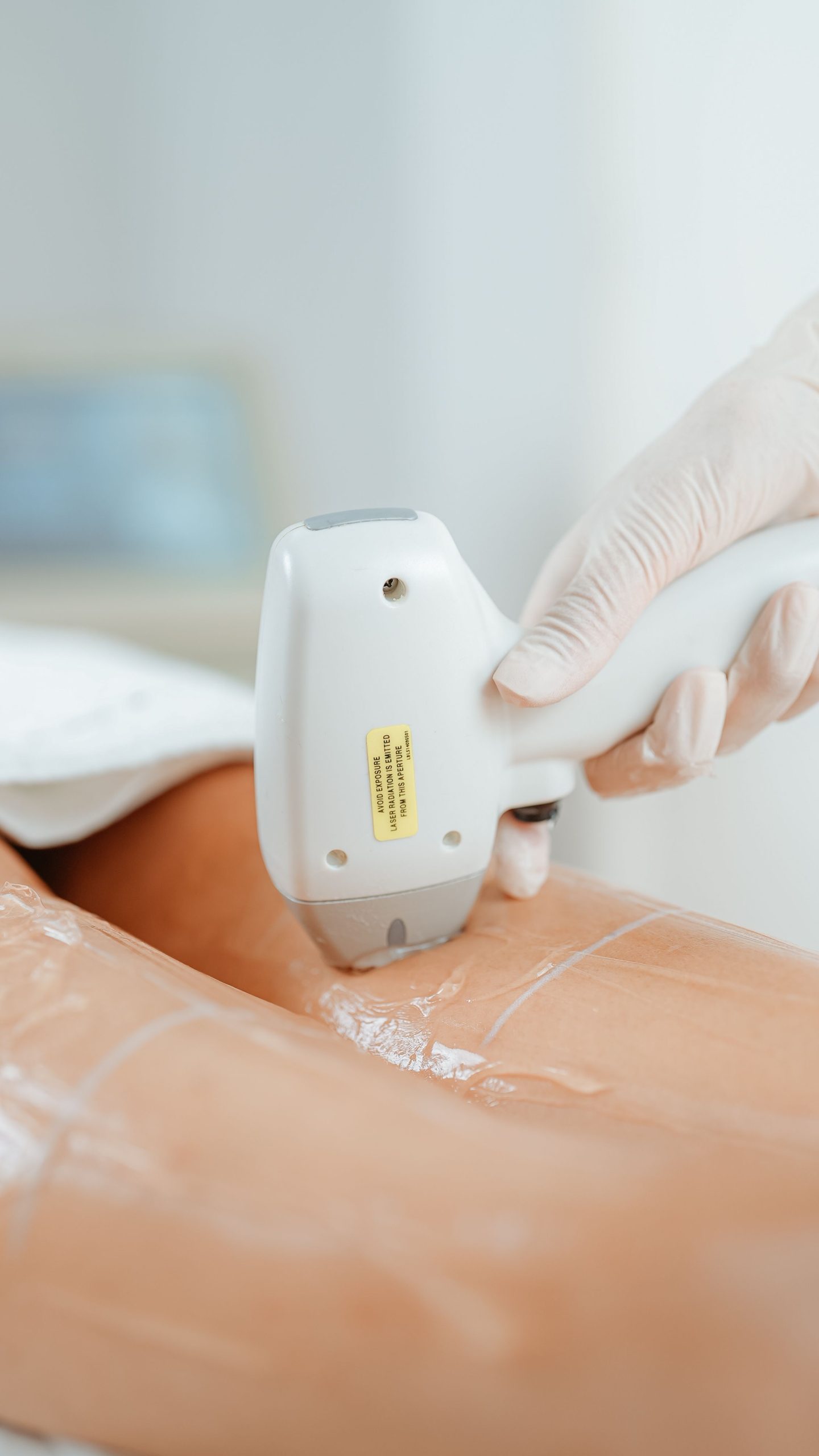 Laser hair removal treatment on the leg at Dr Tanov Eye & Aesthetics